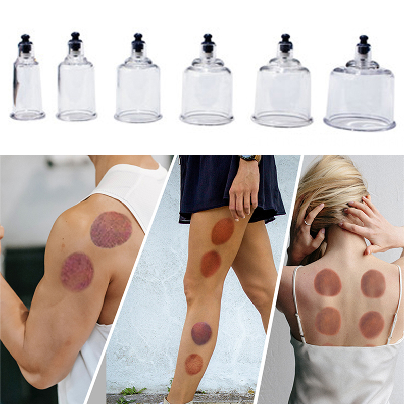 17 Cans Vacuum Cupping Therapy - Cupping Therapy Set review and price
